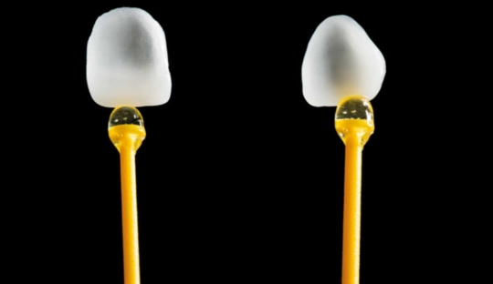 Digitální versus konvenční přístup v estetické stomatologii