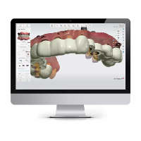 Modelačný softvér Implant Studio