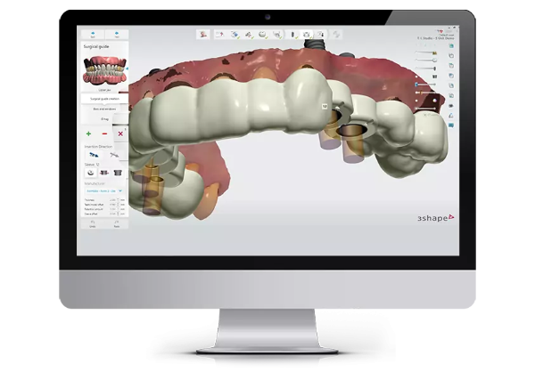 HAPPYDENT LAB: Modelačný softvér Implant Studio