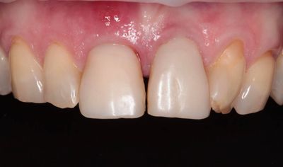 Navigovaná chirurgia, obr. 1