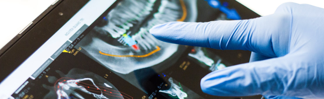 Navigovaná chirurgia v našej praxi – súčasná digitálna stomatológia