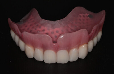 03_Gulickovy_system_mini_implantaty_2