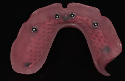 04_Gulickovy_system_mini_implantaty_2