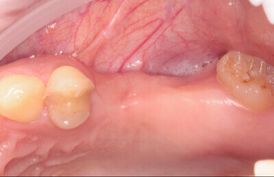 Navigovana chirurgia_01