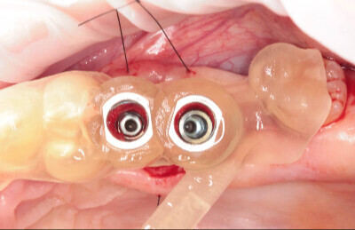 Navigovana chirurgia_02