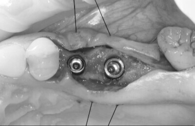 Navigovana chirurgia_03