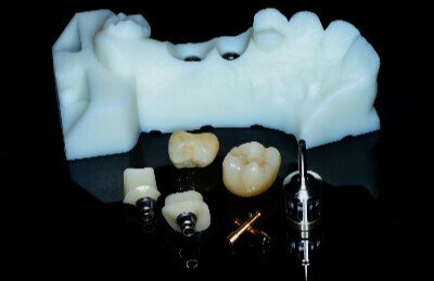 Navigovana chirurgia_04