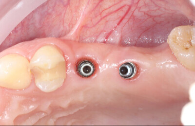 Navigovana chirurgia_05