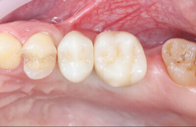 Navigovana chirurgia_06