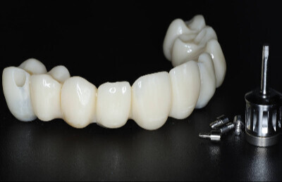 08 Navigovaná chirurgia, 5 implantátov