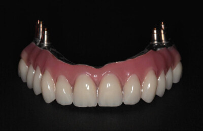 02_Titanovy_strmen_a_ kompozitne_zuby