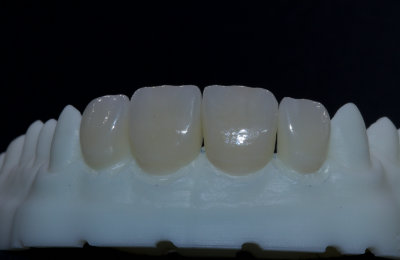 fazety_01_HappyDent_Lab
