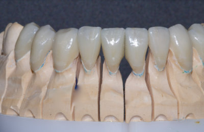 fazety_04_HappyDent_Lab