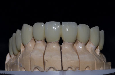 korunky_01_HappyDent_Lab