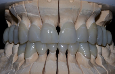 korunky_03_HappyDent_Lab