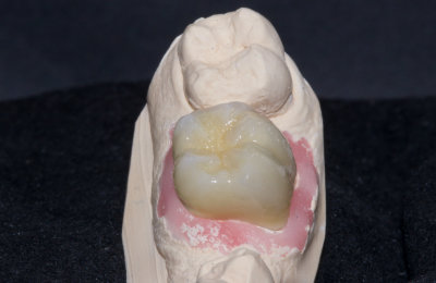 korunky_04_HappyDent_Lab