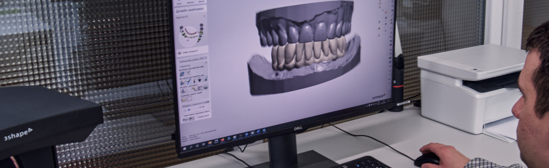 Navigovaná chirurgia, chirurgické šablóny - HAPPYDENT LAB