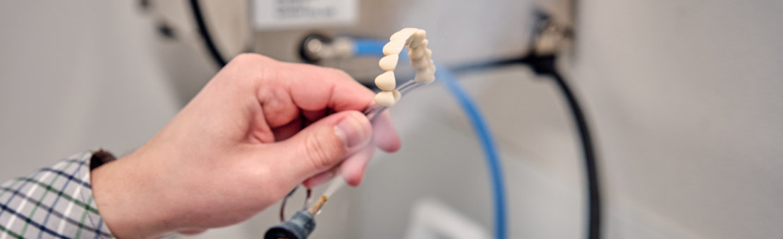 Dočasné konštrukcie - HAPPYDENT LAB