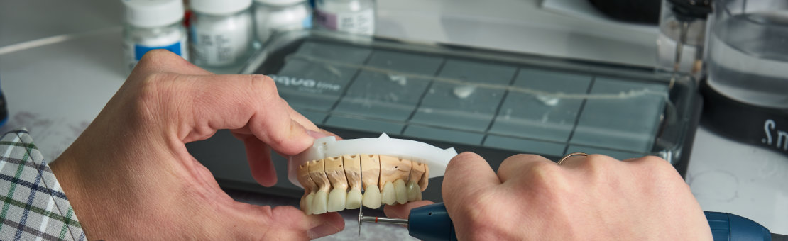 Snímateľné náhrady - HAPPYDENT LAB