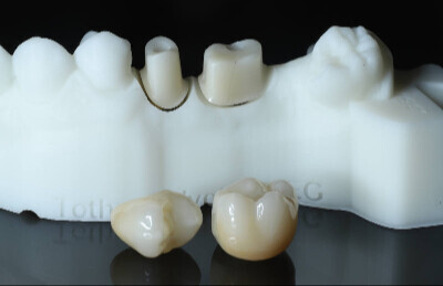 Titanový abutment HappyDent Lab