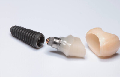 Titanový abutment HappyDent Lab