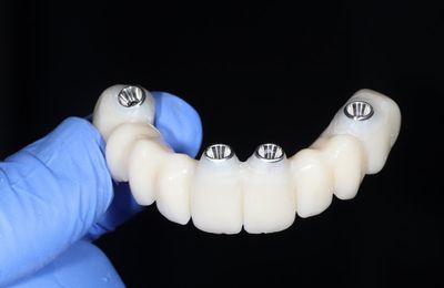 Dočasné konštrukcie, HAPPYDENT LAB