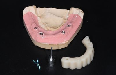 Dočasné konštrukcie, HAPPYDENT LAB
