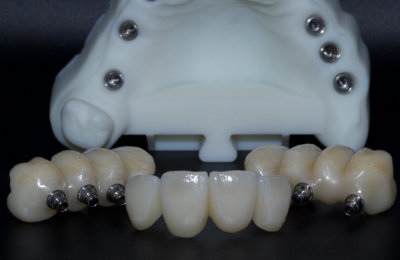 korunky_03_HappyDent_Lab