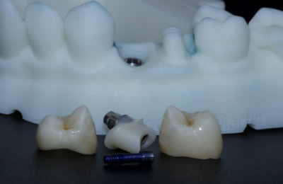 korunky_04_HappyDent_Lab