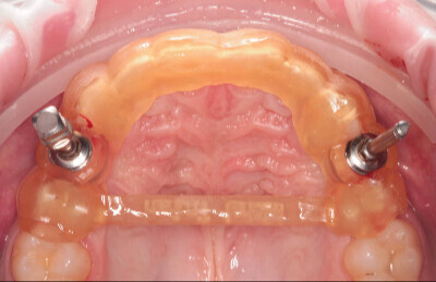 Navigačná šablóna HappyDent Lab 