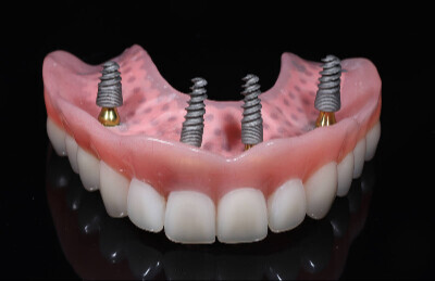Snimatelna náhrada na lokatoroch